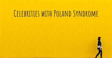 famous people with poland syndrome